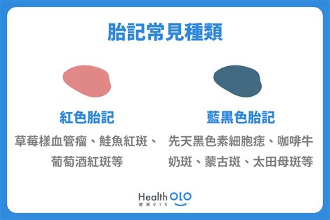 屁股青色胎記|胎記怎麼產生、何時消除？醫師剖析胎記種類、胎記寓意